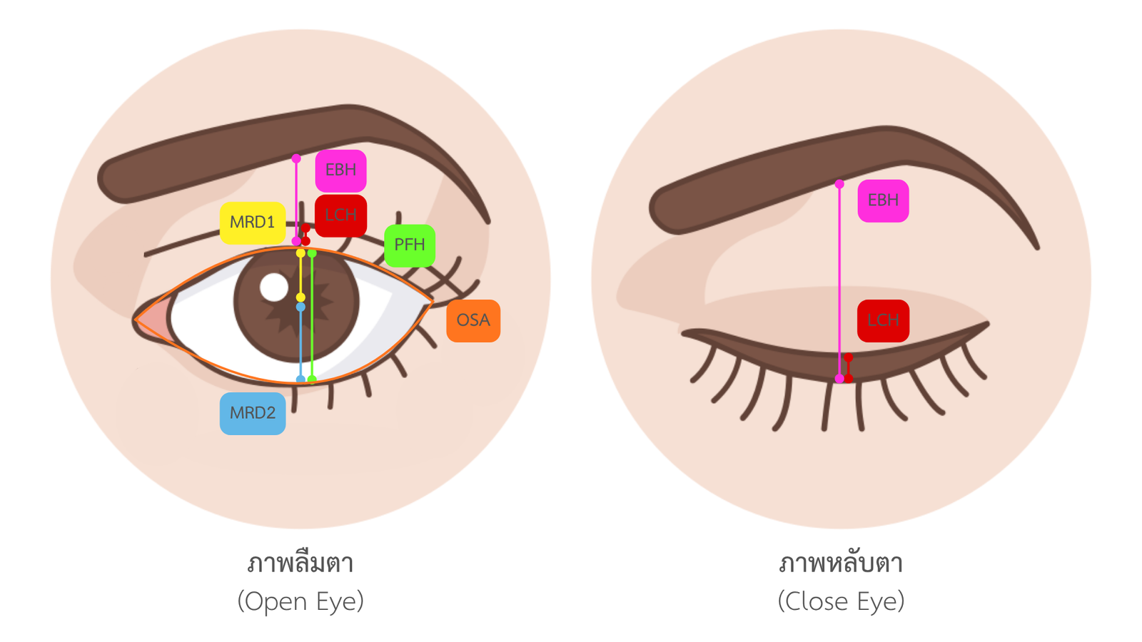 Eye Point Information 1
